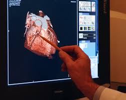 Компьютерная томографмя сердца